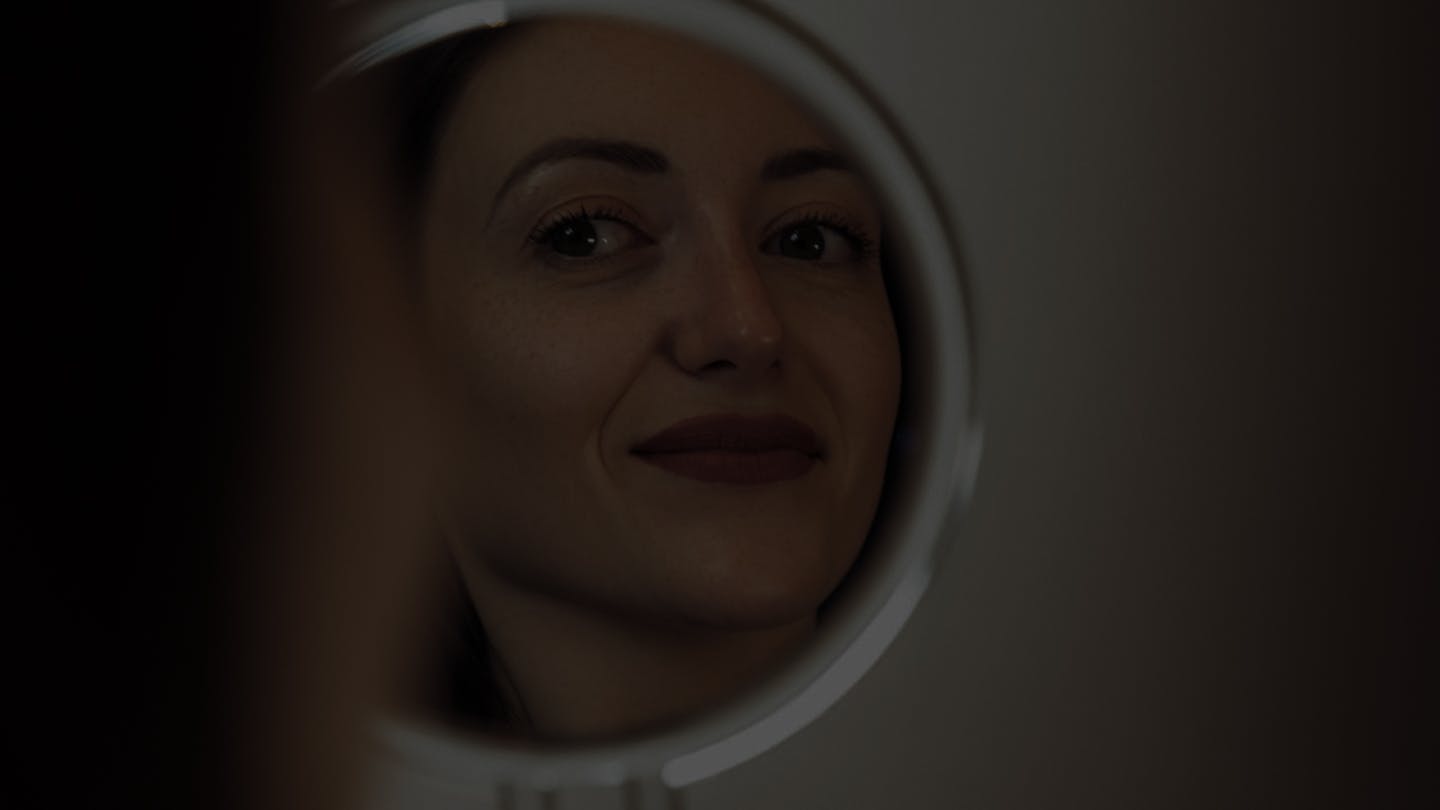 Résultat pour une blépharoplastie supérieure par le Dr. Mertens
