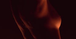 Quelle cicatrice pour un lifting mammaire pour ptose mammaire par le Dr Mertens