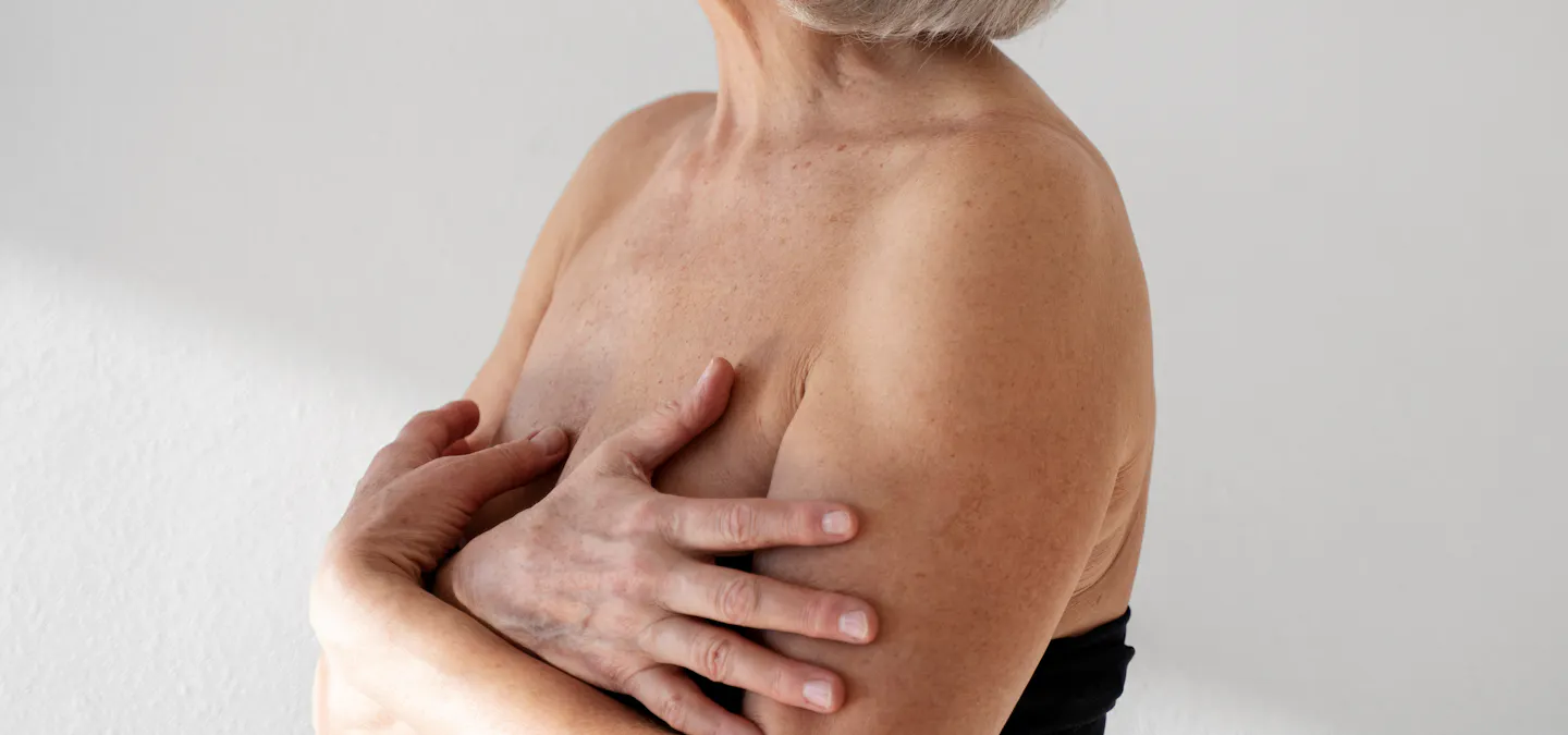 mastopexie : qu'est-ce que le lifting mammaire ? Dr. Mertens