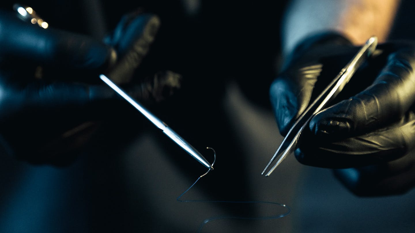 Intervention & chirurgie Malformations mammaires : seins tubéreux, asymétrie mammaire par le Dr. Alexandre Mertens