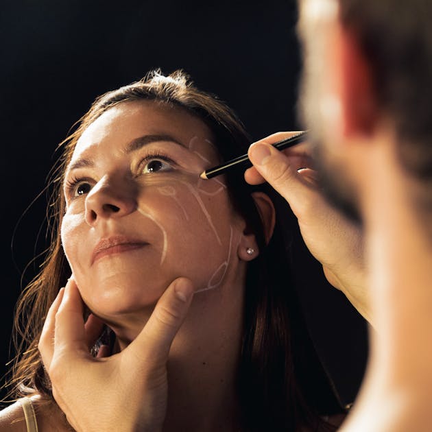 Acide hyaluronique dans les cernes par le Dr. Alexandre Mertens à Lyon Vienne