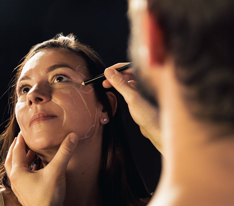 Une solution simple, rapide, efficace et sur mesure pour redonner de la plénitude au visage, sans chirurgie : le lifting médical par acide hyaluronique à Lyon Vienne par le Dr. Alexandre Mertens