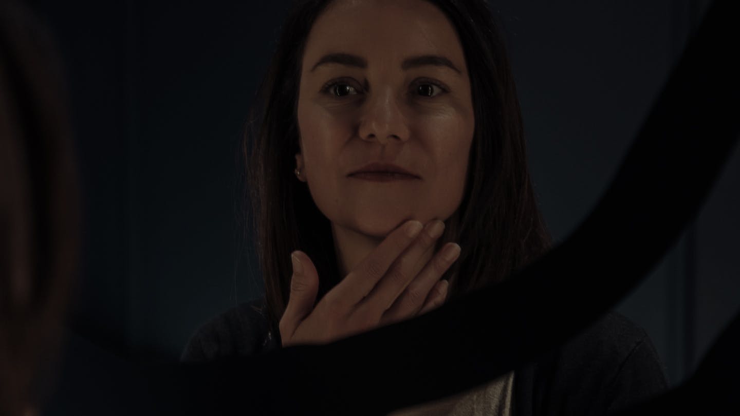 Suite et résultats des fils tenseurs par le Dr. Alexandre Mertens