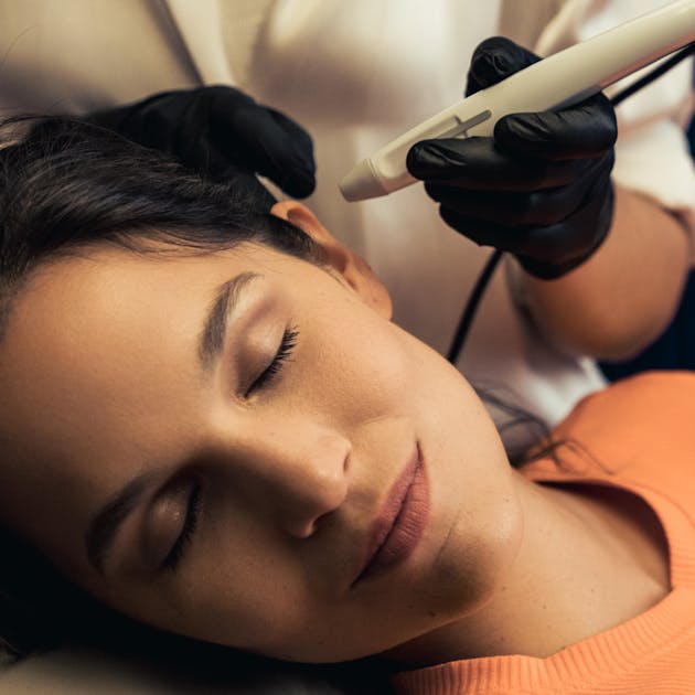 La Radiofréquence Microneedling à Lyon Vienne par le Dr Mertens