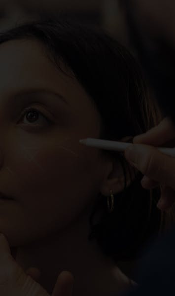 Acide Hyaluronique cernes