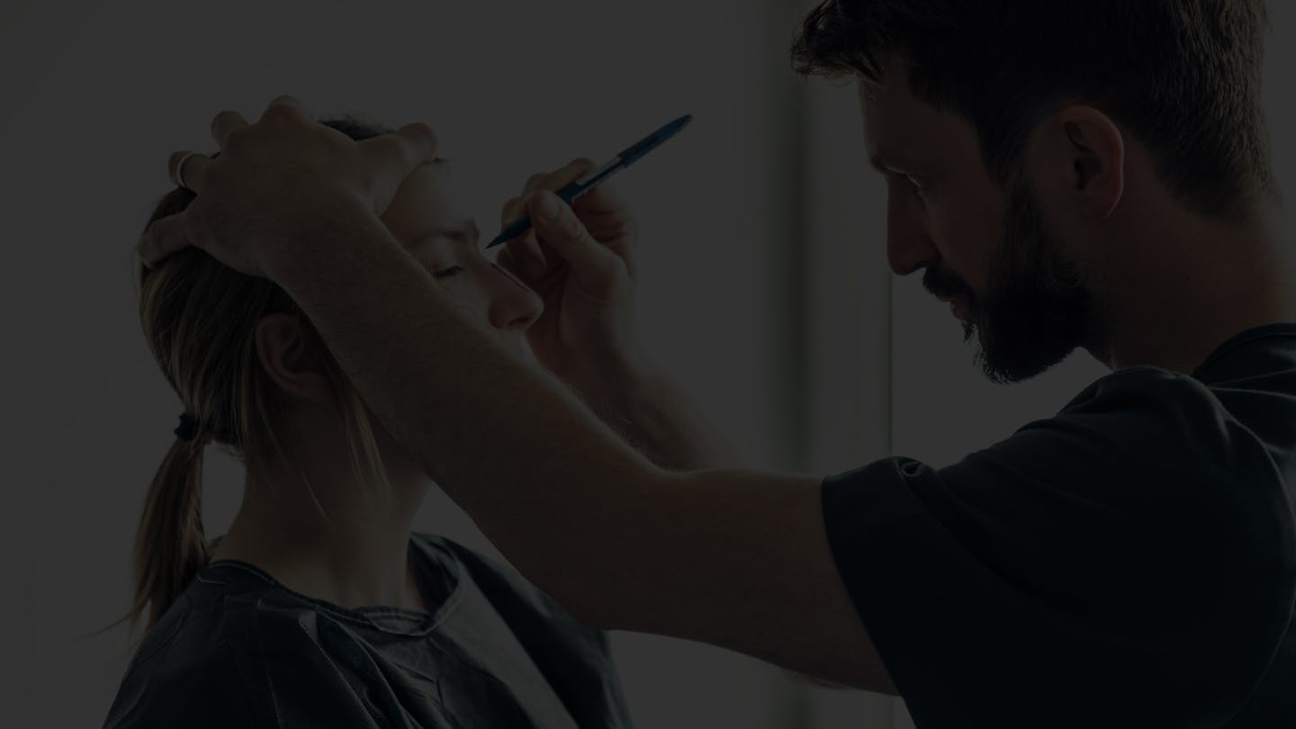 Rhinoplastie primaire par le Dr. Alexandre Mertens