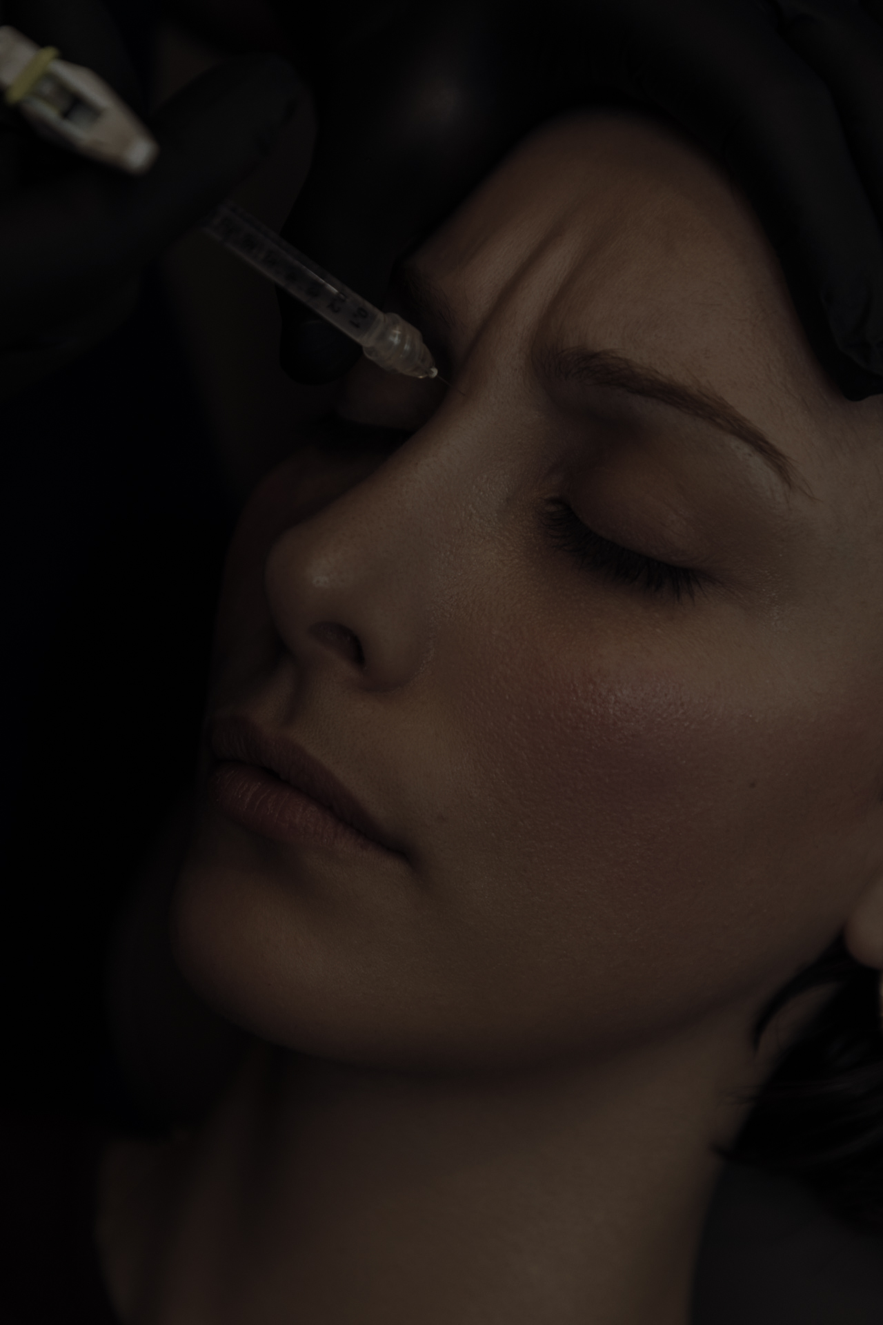 Injections de Botox par le Dr. Alexandre Mertens