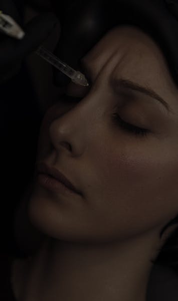 Injections de Botox par le Dr. Alexandre Mertens