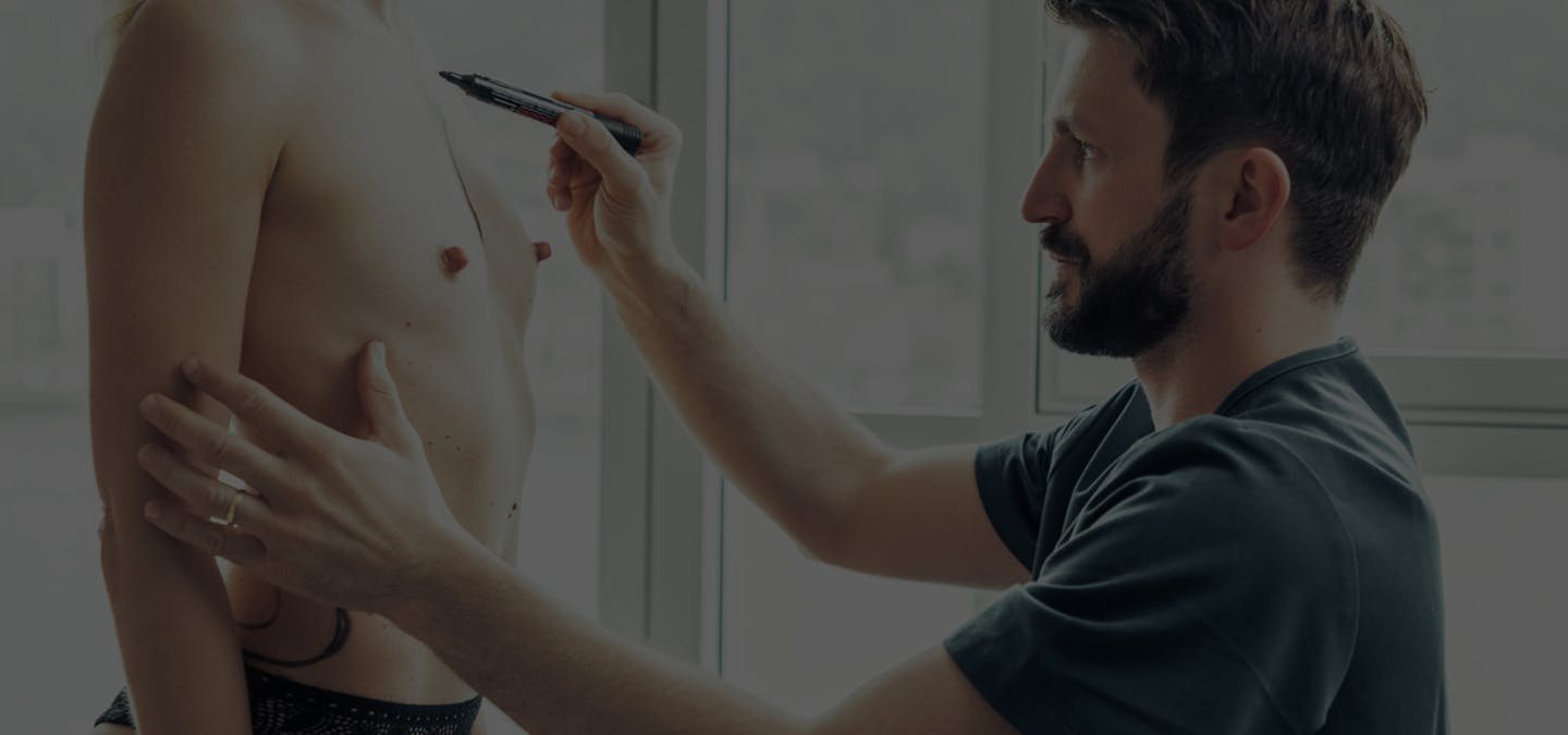 Comprendre et préserver l'écart entre les seins après une augmentation mammaire