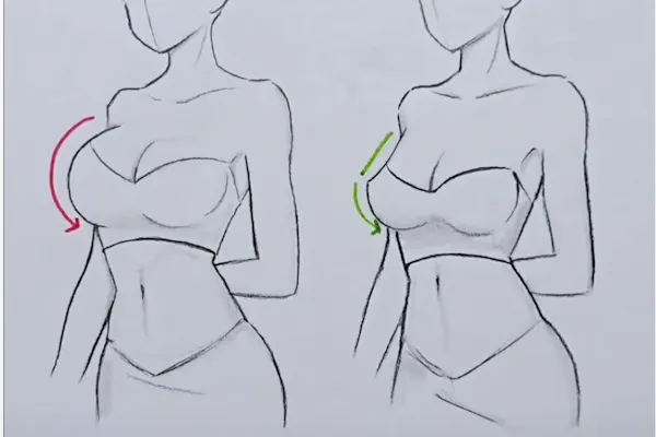 le décolleté après augmentation mammaire | Dr. Mertens