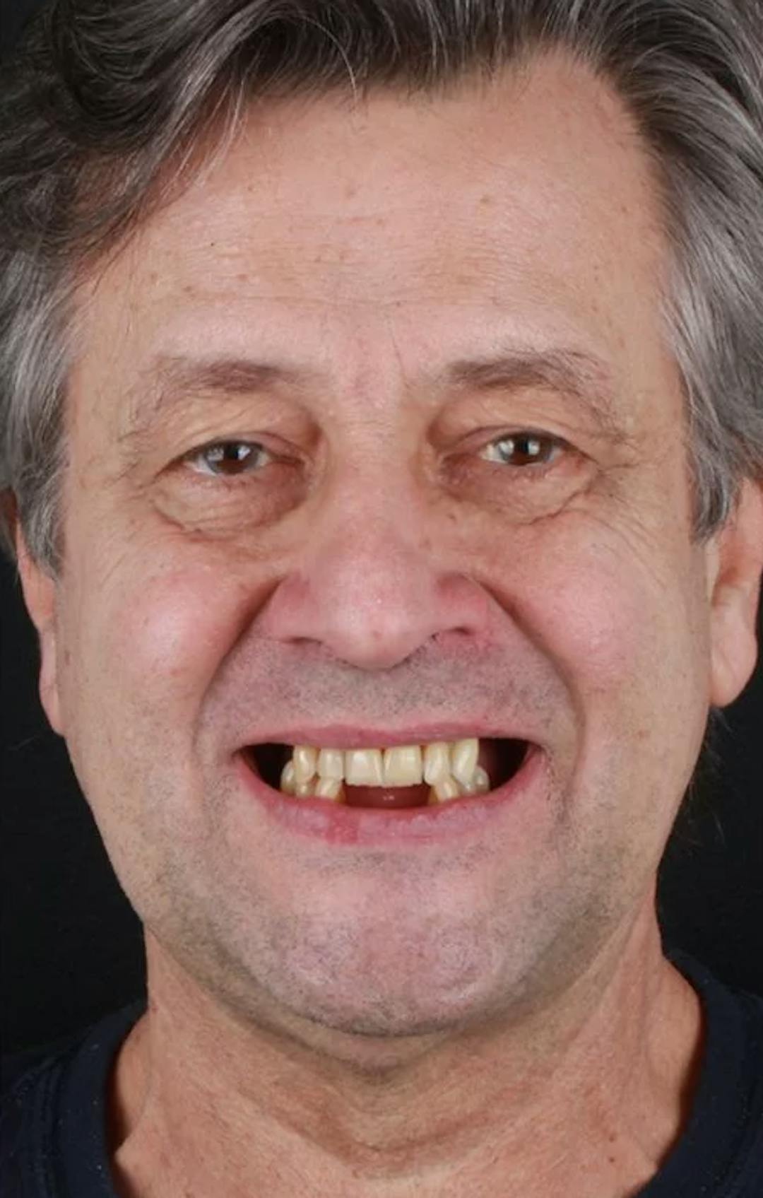 patient before image