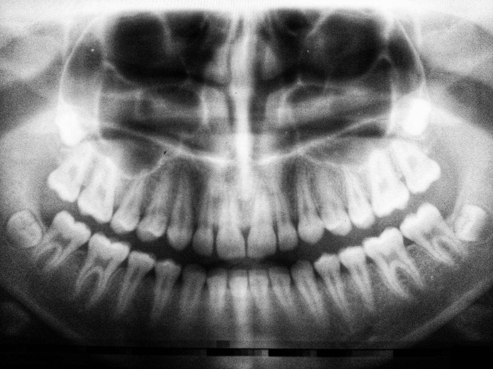 scan of teeth 