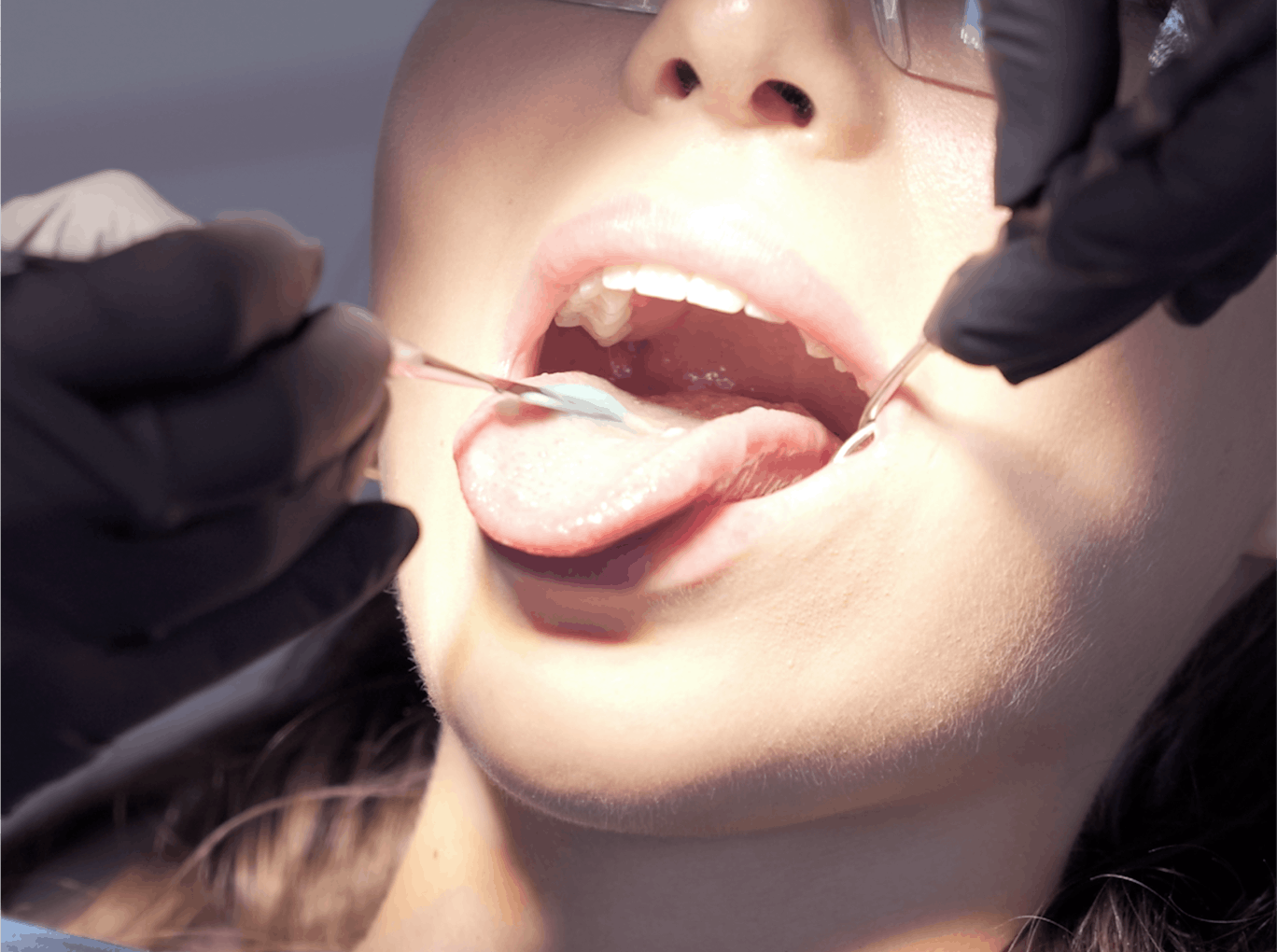 zahnreinigung, alpine white