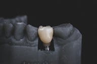 ALPINE WHITE, dental implants