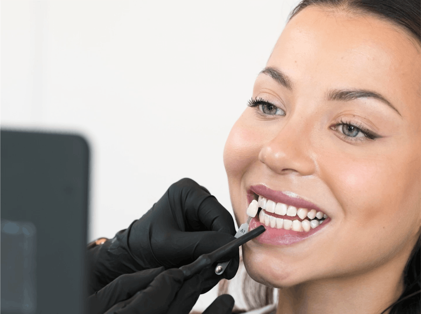 Bestimmung Zahnfarbe