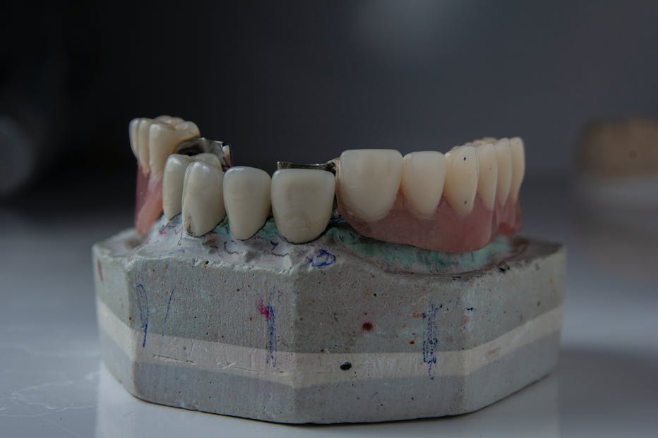 Alpine White, coroas dentárias, coroa dentária, implante dentário, dentes naturais, coroas dentárias, dente natural, saúde bucal, higiene bucal, tipos de coroa, prótese dentária, tipos de coroas, coroa de porcelana, ponte dentária, coroa provisória, coroas de porcelana, estrutura interna, creme dental, tratamento odontológico, estrutura metálica, aparência natural, coroas de resina, prótese provisória, canal radicular, pontes dentárias