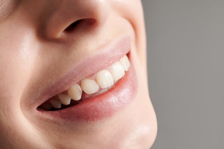 alpine white, fitas clareadoras, fitas de clareamento dental, carvao clareador, carvao ativado, limpeza dental, clareamento dental, saúde bucal, higiene bucal, esmalte dos dentes, esmalte dental, esmalte dentário