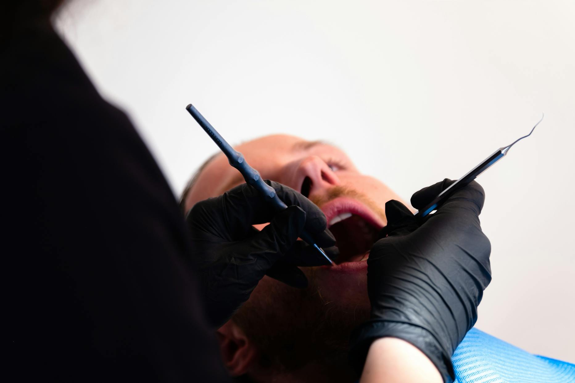 Dental hygiene in Switzerland What it costs and why it's worth it