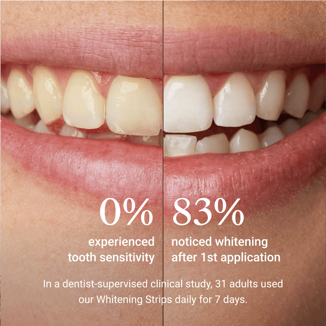 Alpine White, Whitening Strips Sensitive