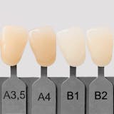 bleaching, bleaching zurich, teeth whitening