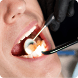alpine white, dental hygiene, healthy teeth, professional teeth cleaning, alpine white studio, Zurich, Switzerland