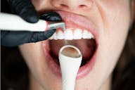 interdental spaces, dental floss, interdental brushes, cavities, dental plaque, gum inflammation, periodontitis, oral hygiene, dentures, implants, braces, oral irrigator, dental care, dental health, gums, professional dental cleaning, ALPINE WHITE, Sonic Toothbrush, Plaque, tooth surfaces, interdental cleaning, healthy teeth, healthy gums