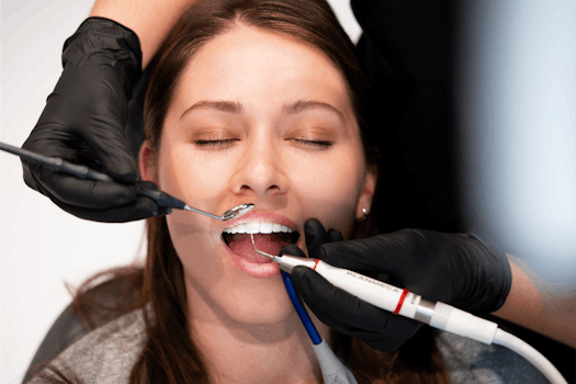 Teeth cleaning, professional teeth cleaning, PTC, dental health, dental care, tartar, gums, caries, tooth discolouration, interdental spaces, dental hygienist, oral hygiene, dentist's office, fluoride, gum inflammation, discolouration, tooth enamel, dental plaque, ALPINE WHITE, healthy teeth, aftercare, mouthwashes