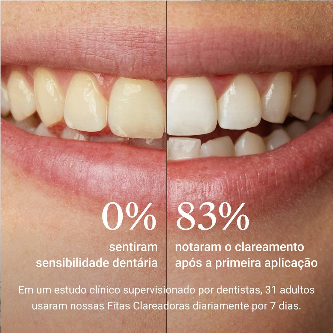 Fitas Clareadoras ALPINE WHITE para clareamento dental, com tecnologia suíça comprovada, ideais para clarear os dentes em casa, sem sensibilidade e com resultados visíveis em apenas 3 dias.