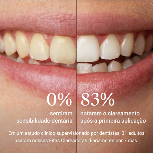 Fitas Clareadoras ALPINE WHITE para clareamento dental, com tecnologia suíça comprovada, ideais para clarear os dentes em casa, sem sensibilidade e com resultados visíveis em apenas 3 dias.