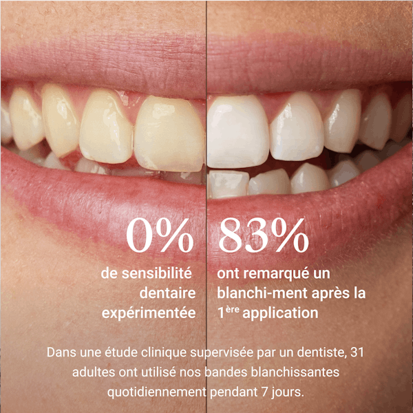 Bandes de blanchiment, bandes blanchissantes, Bleaching, Alpine White