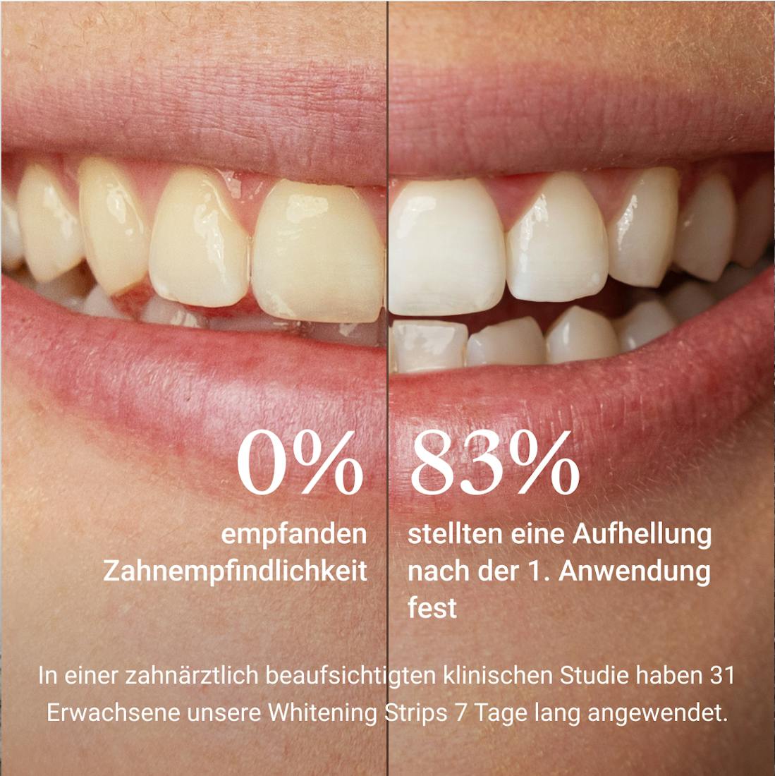 Whitening Strips, Bleaching, Alpine White