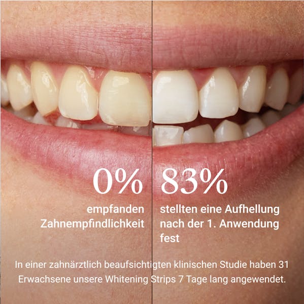 Whitening Strips, Bleaching, Alpine White