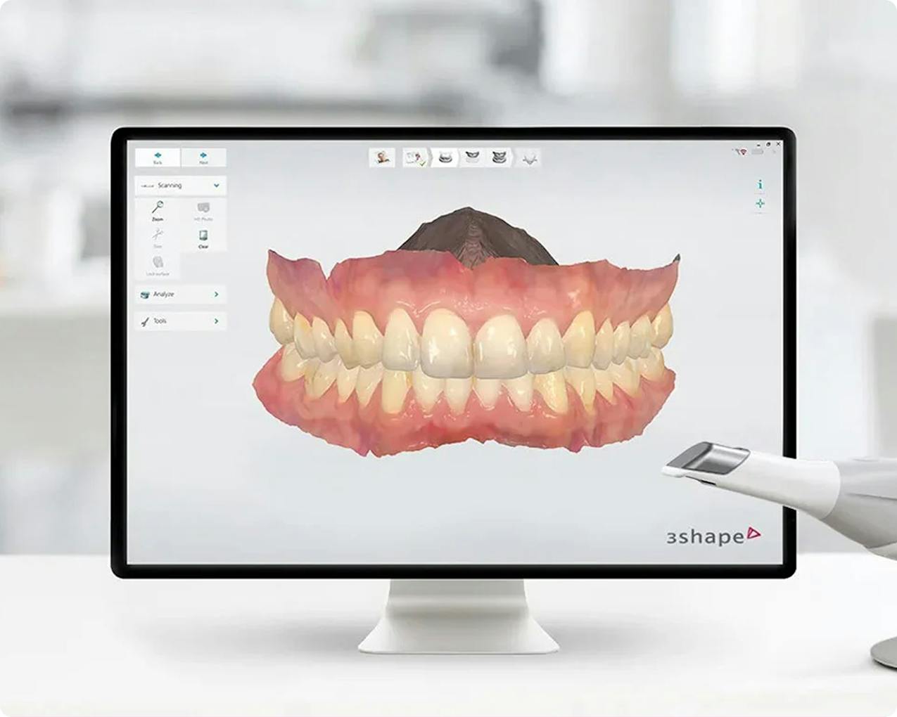 Aligner, invisible aligners, aligner treatment, aligner Switzerland, Spark aligner, teeth straightening, aligner trays, braces alternative, correcting tooth position, aligner cost, aligner experiences, aligner consultation, order aligners online, aligner provider, aligner test, Alpine White aligner, transparent aligners, adult teeth straightening, aligner wearing comfort, buy aligner trays