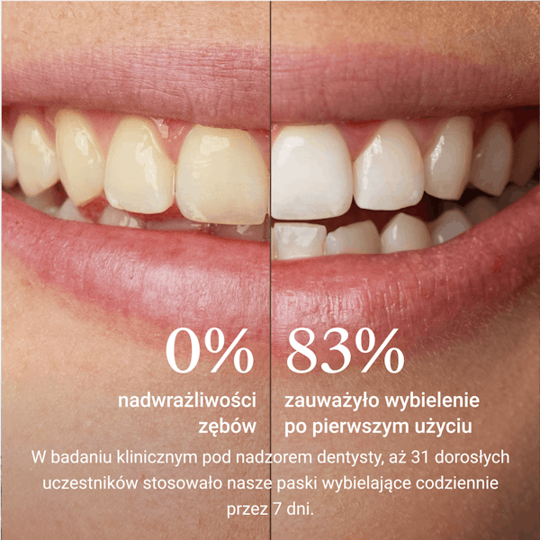 Whitening Strips, Bleaching, Alpine White