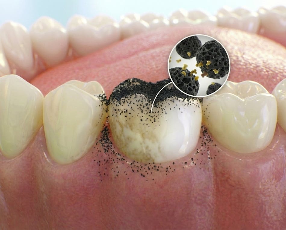 Carvão Clareador ALPINE WHITE – pó clareador dental com carvão ativado, que remove manchas, placa bacteriana e tártaro naturalmente, deixando os dentes mais brancos e o hálito refrescante. Produto vegano e cruelty-free.