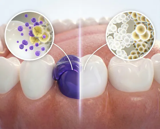 Whitening Strips, Colour Correct, Whitening Strips, Alpine White, Bleaching