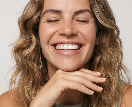 Whitening Strips, Colour Correct, Whitening Strips, Alpine White, Bleaching