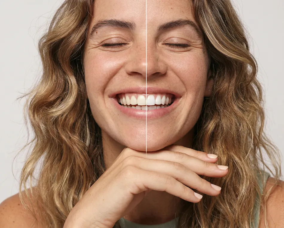 Whitening Strips, Colour Correct, Whitening Strips, Alpine White, Bleaching