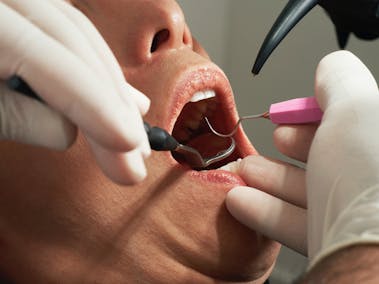 Toothache, dental hygiene, oral hygiene, pain relief, sensitive teeth, tooth cleaning, dental care, home remedies, gingivitis, gum pain, dental treatments, dental health, bleeding gums, tooth discolouration, tartar, plaque, fluoride, dental floss, toothpaste, visit to the dentist, mouthwash, gum care, tooth sensitivity, dental care products, gum irritation