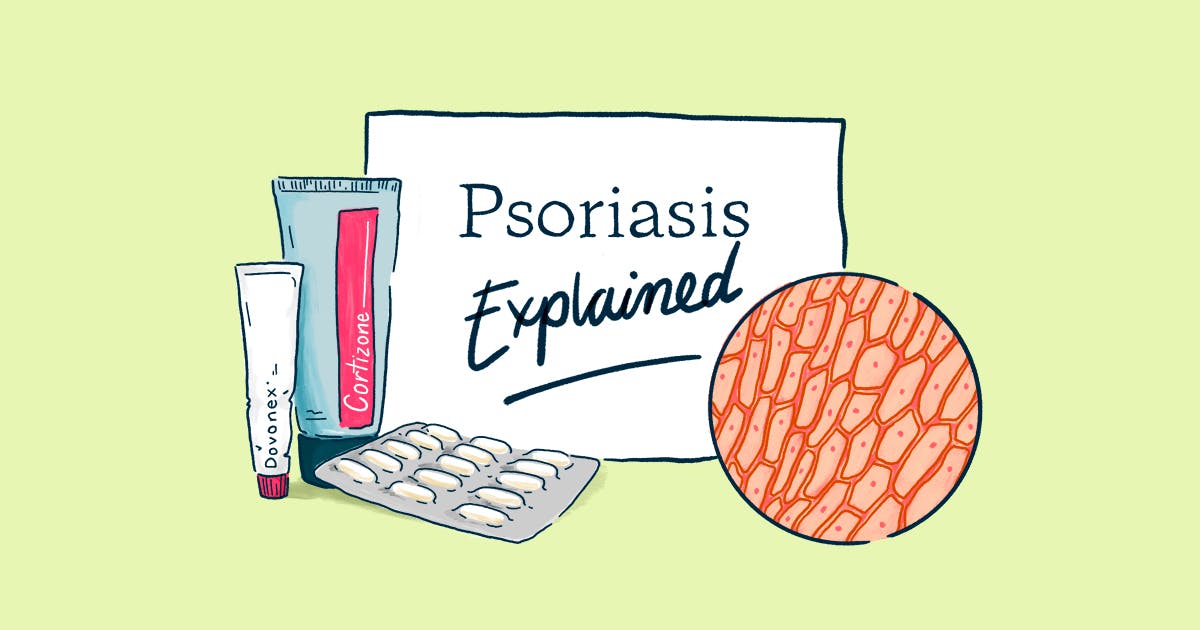 Psoriasis, Explained