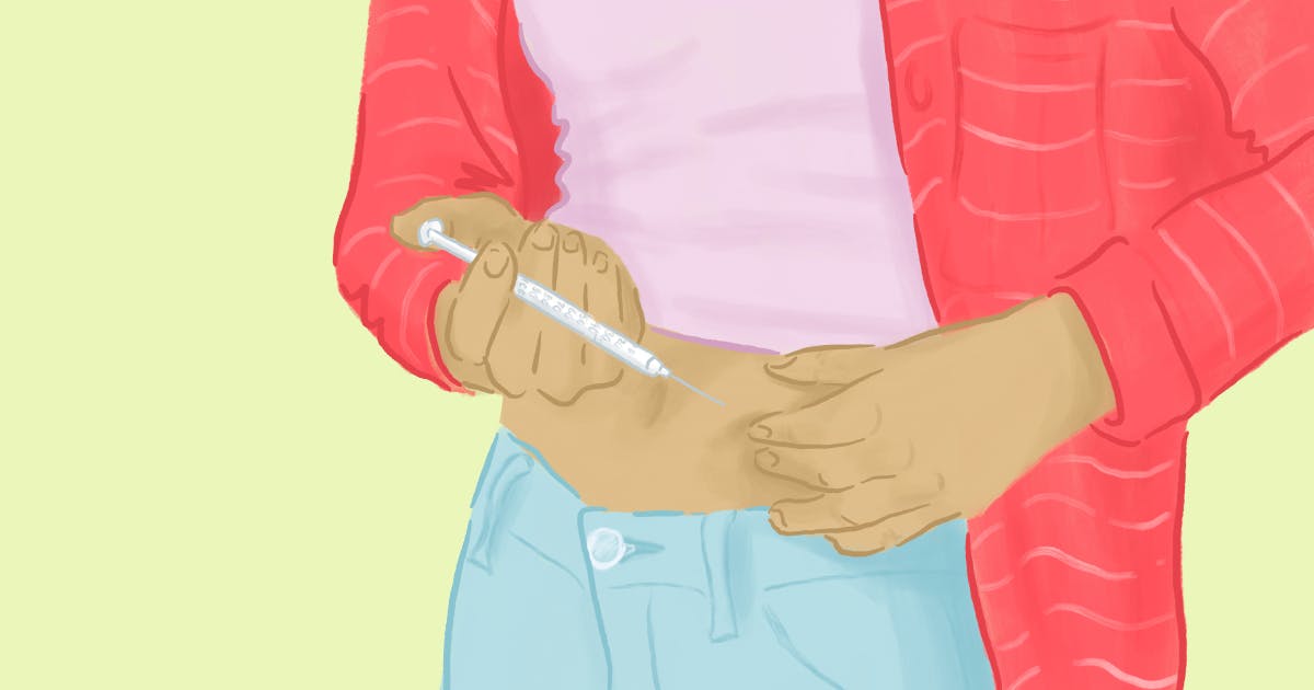 Intramuscular and Subcutaneous Injections During IVF
