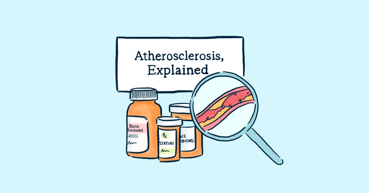 Atherosclerosis, Explained
