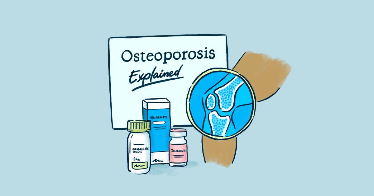 Osteoporosis Explained