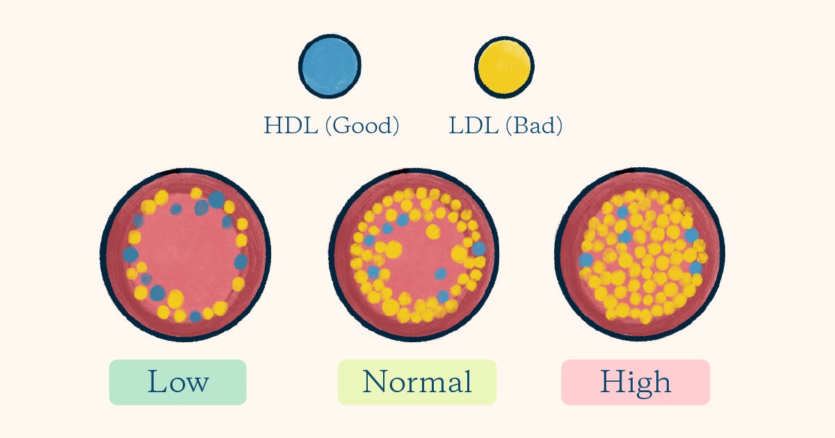 latest tips for better cholesterol balance