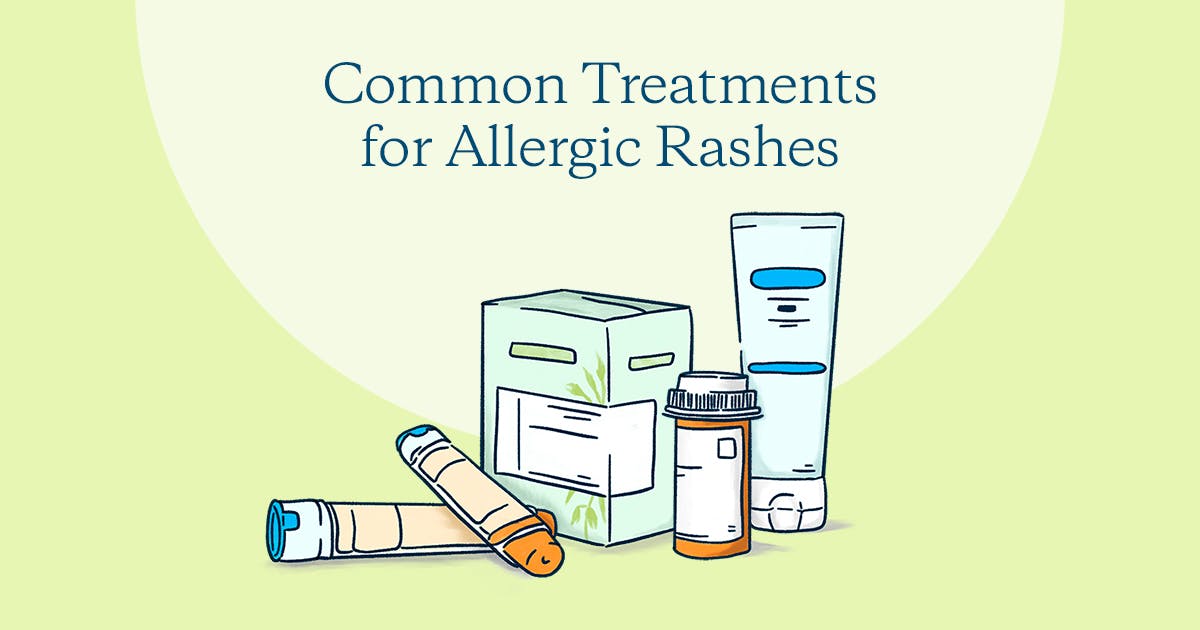 Common Treatments for Allergic Rashes