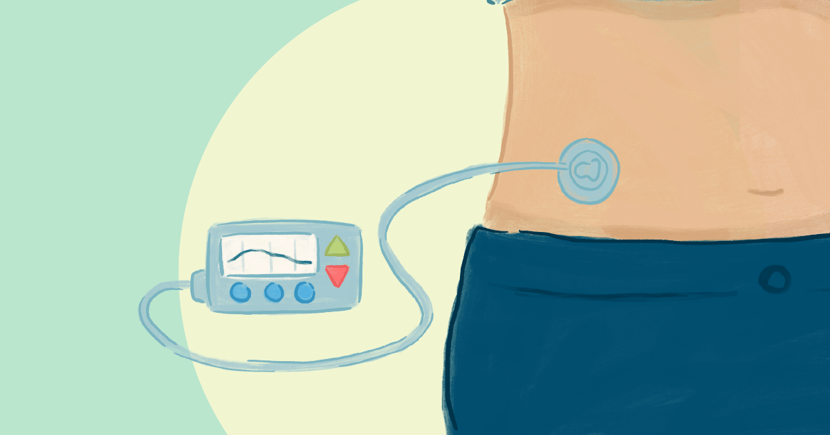 The Role Of Insulin Pumps In Diabetes Treatment 