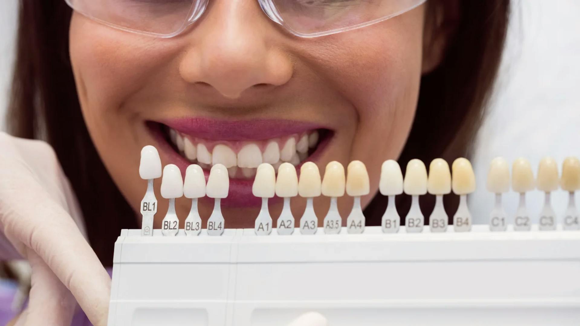 Dentista mostrando para paciente tons de dentes para clareamento dentário
