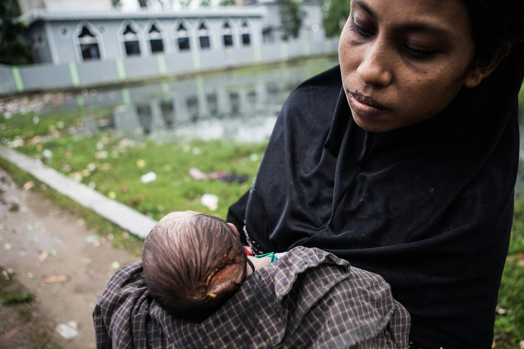 Une femme montre son nouveau né blessé par une balle des forces armés birmanes