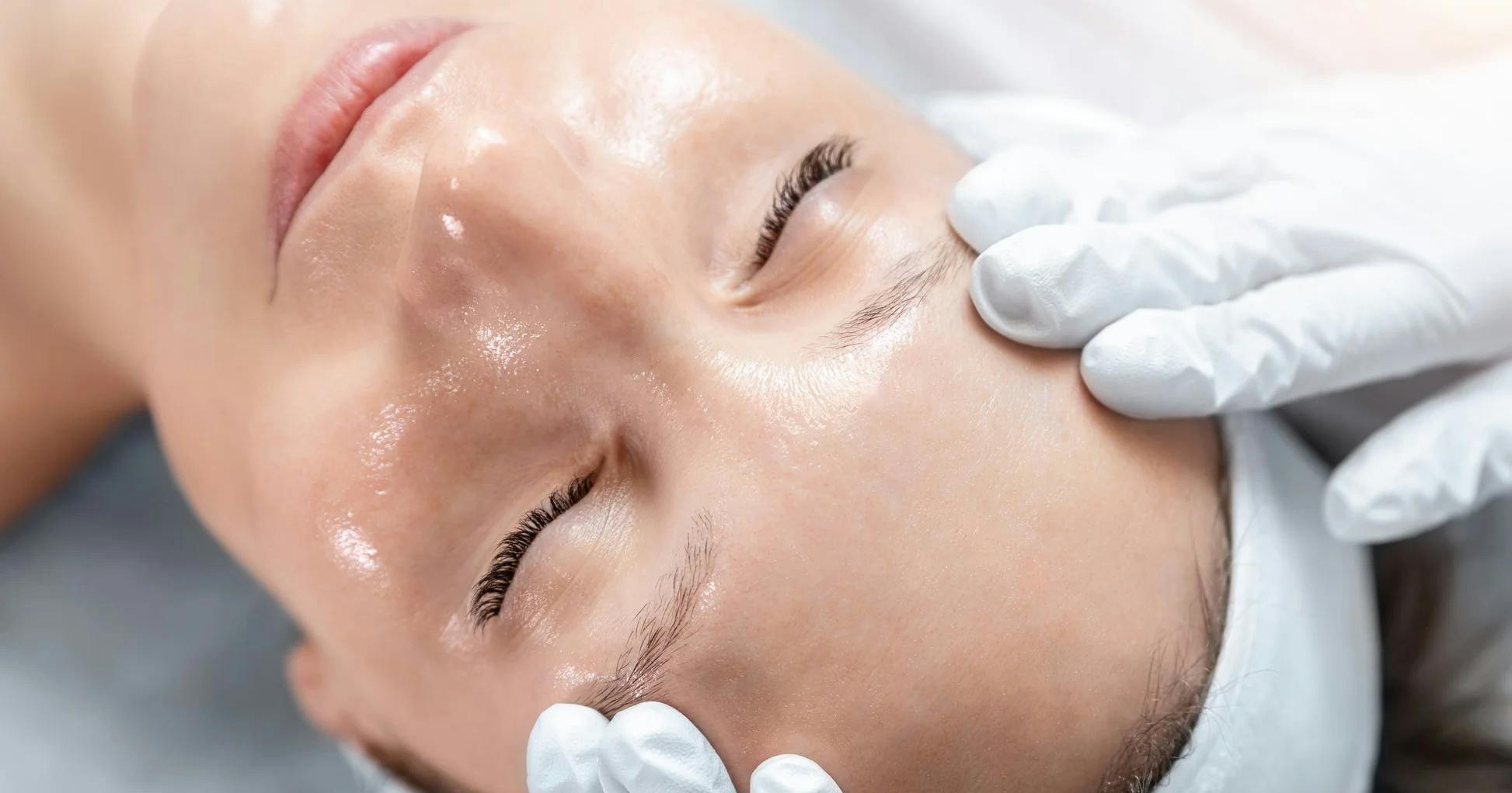 A female patient receiving nopeel peel