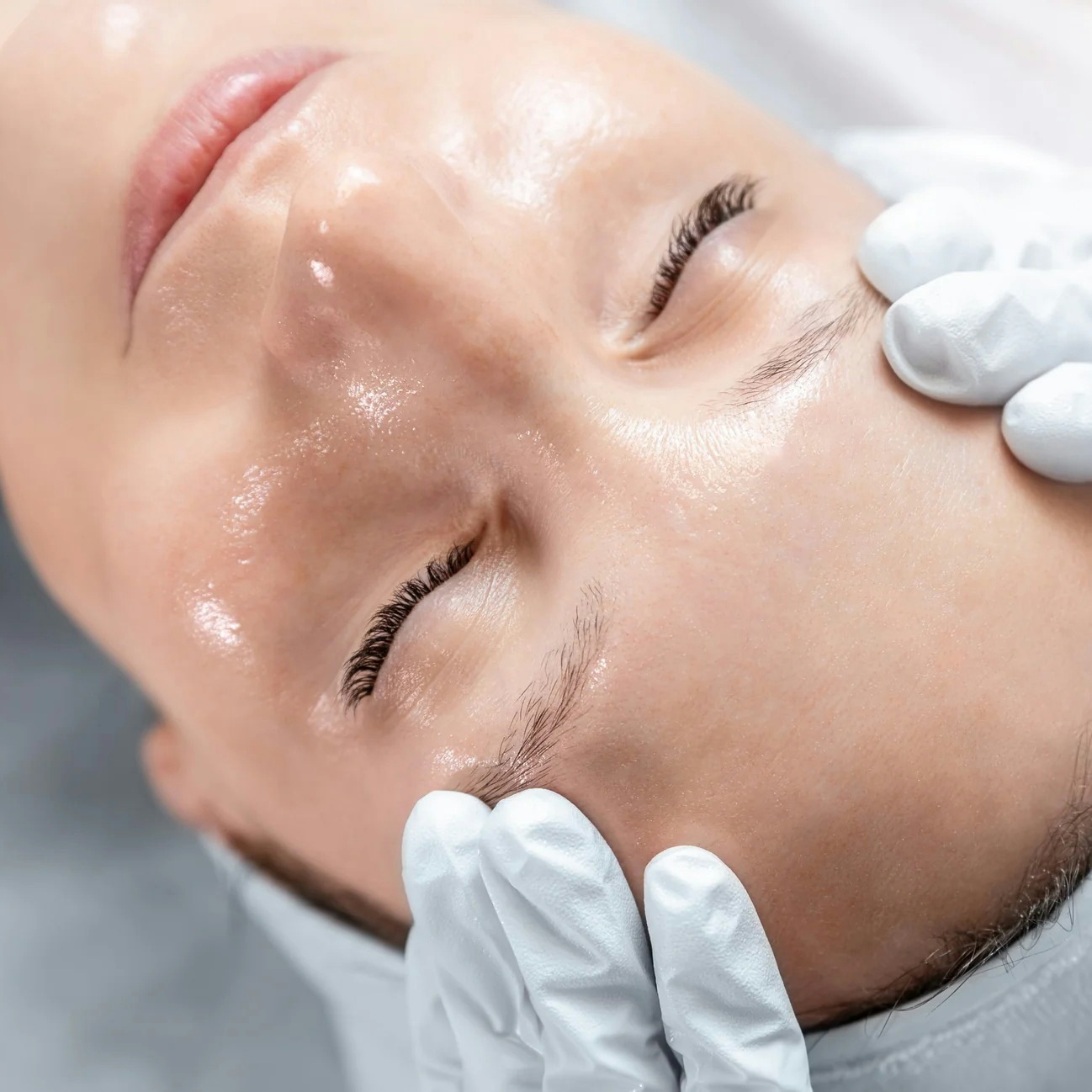 A female patient receiving nopeel peel